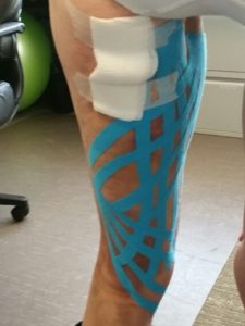 Kinesiology Tape Works!