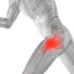 Rehabilitation for Hip Pain