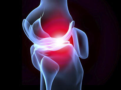 injuries-osteoarthritis