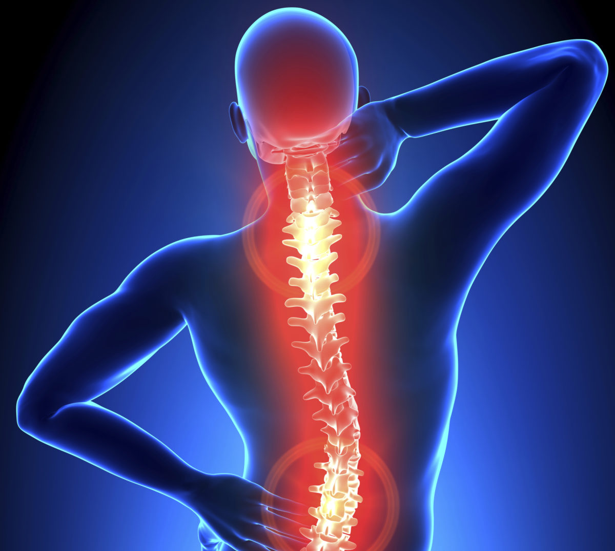 McKenzie Approach for Treating the Spine | Premier Therapy